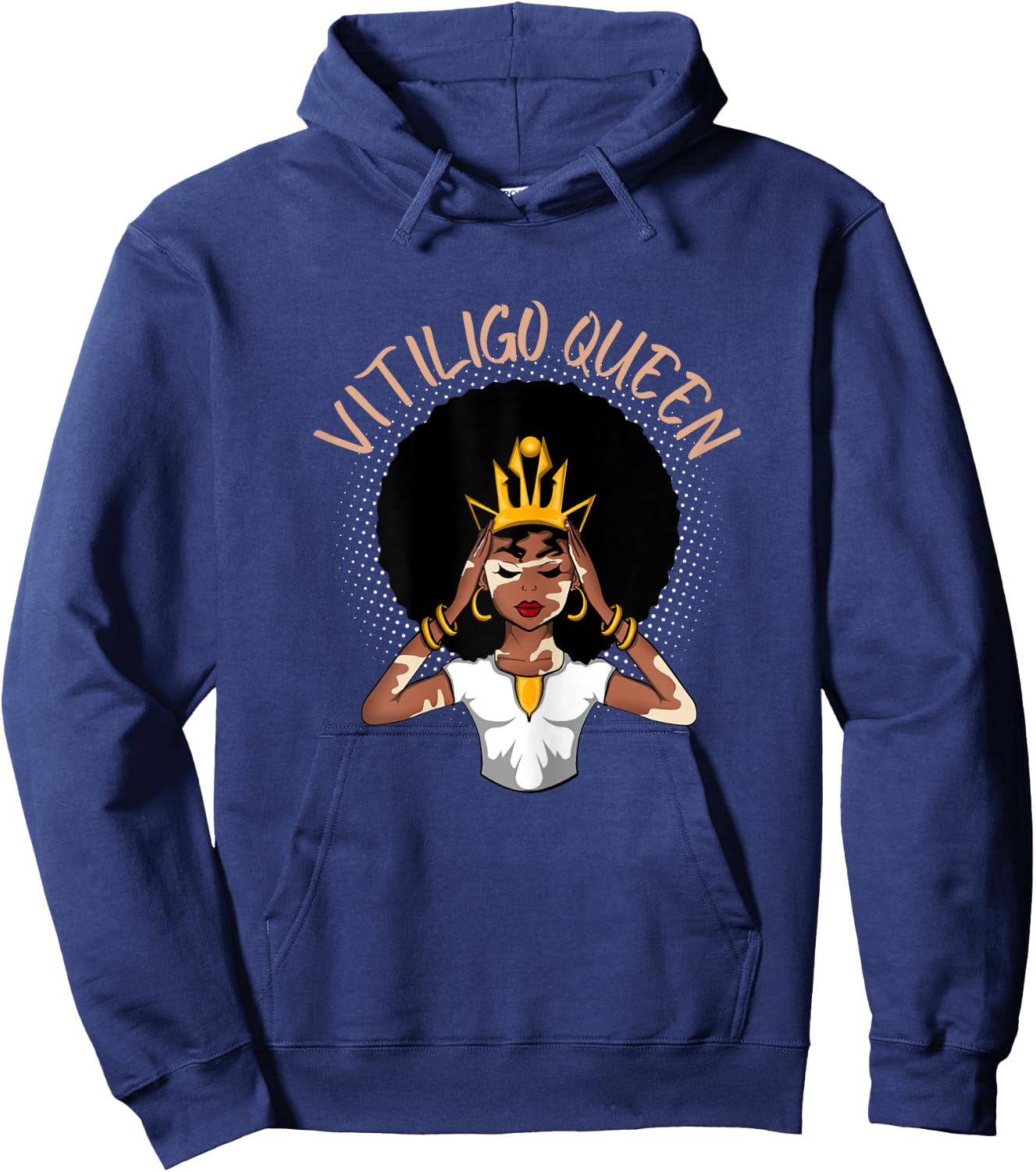 Vitiligo Queen Hoodie - Hoodie | Navy