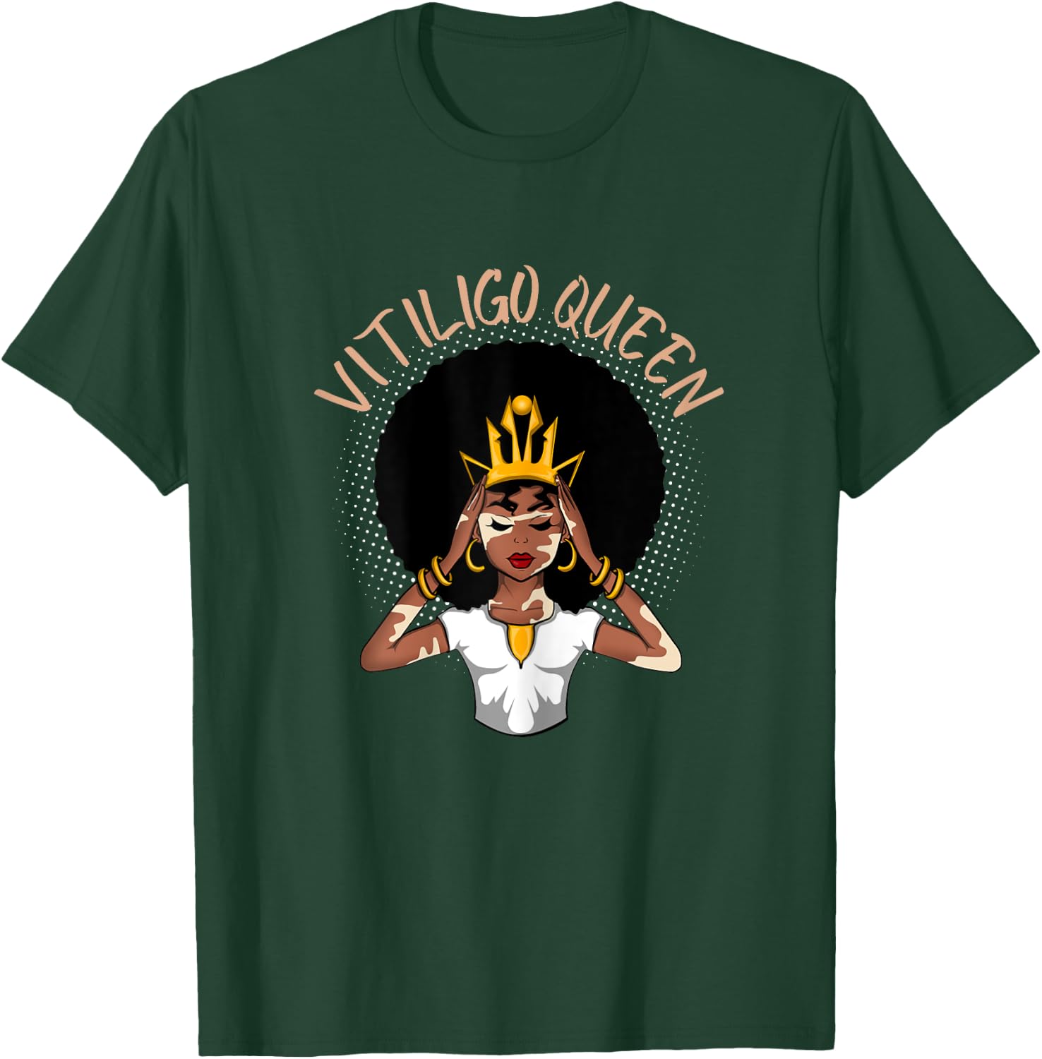Vitiligo Queen T-Shirt - T-Shirt | Forest
