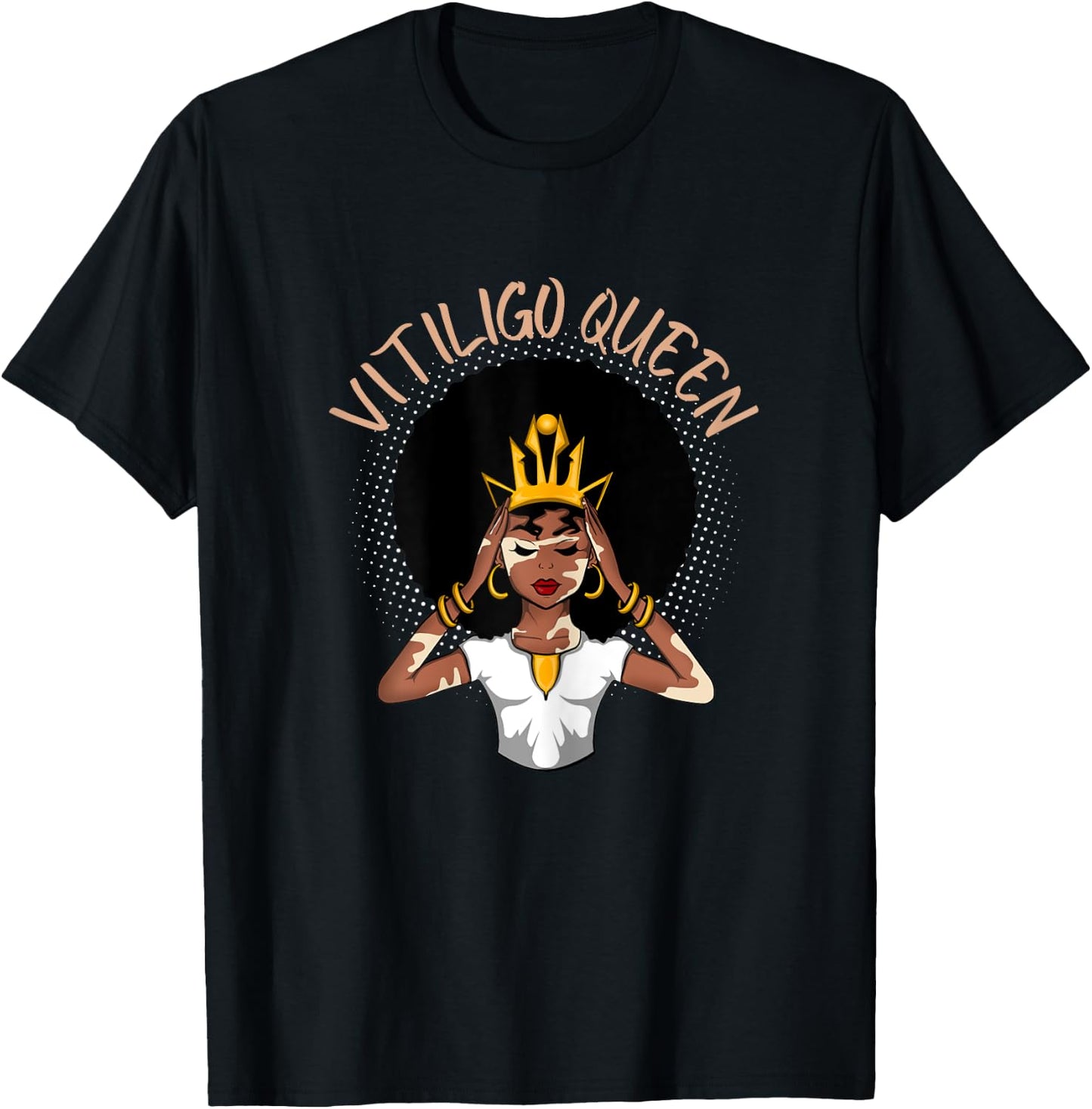 Vitiligo Queen T-Shirt - T-Shirt | Black